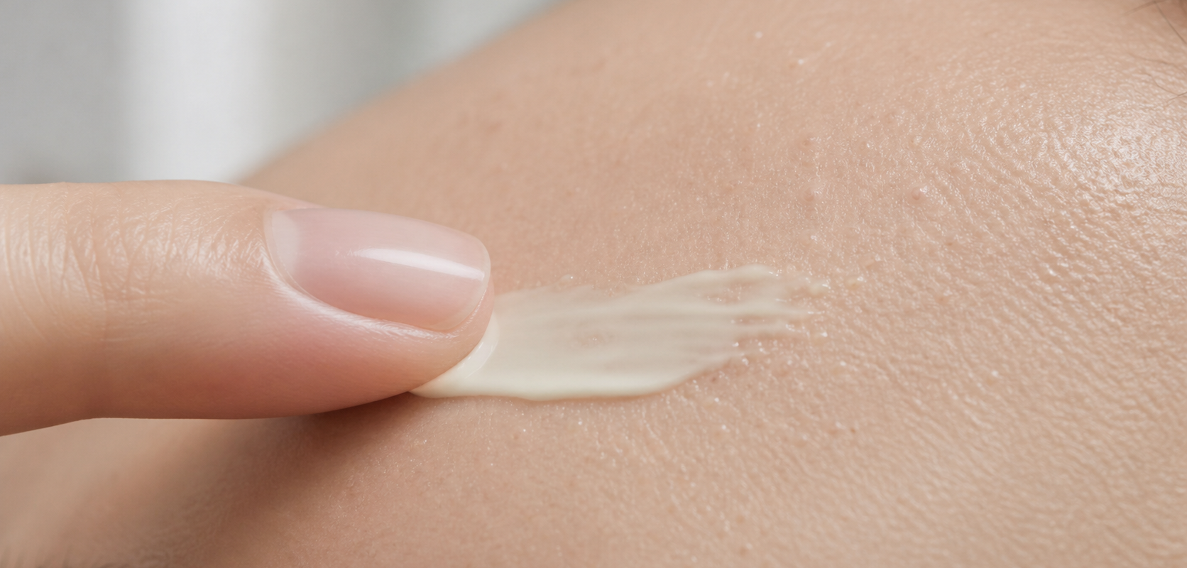 Application d’une fine couche de crème à l’acide azélaïque sur une zone de petits boutons uniformes